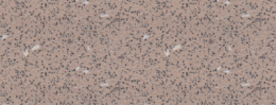 Safety flooring - Plancher Anti-dérapant - Image 8